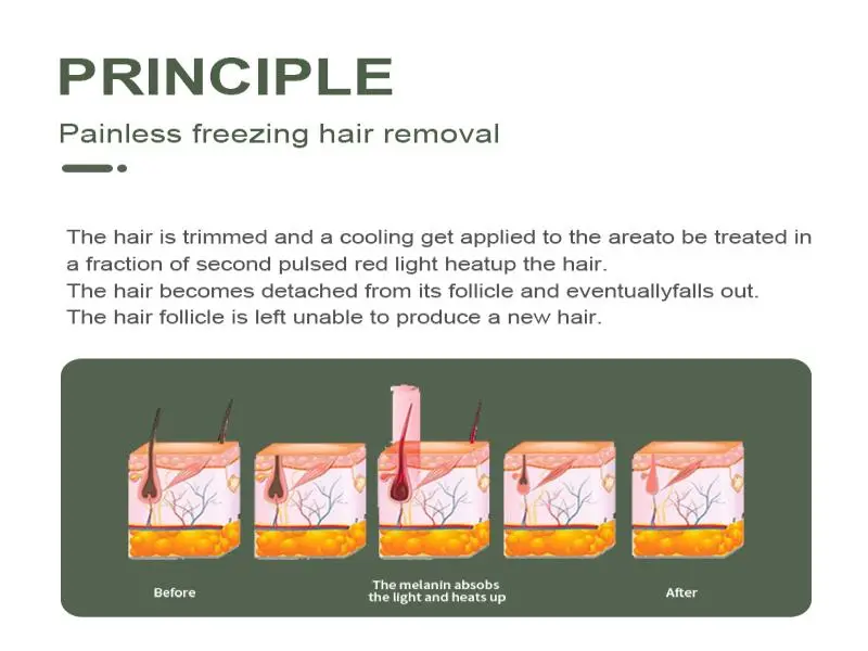 professional laser hair removal device made in China professional laser hair removal device made in China