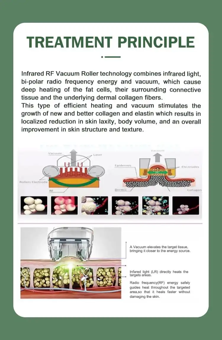 velashape body slimming machine made in china velashape body slimming machine made in china