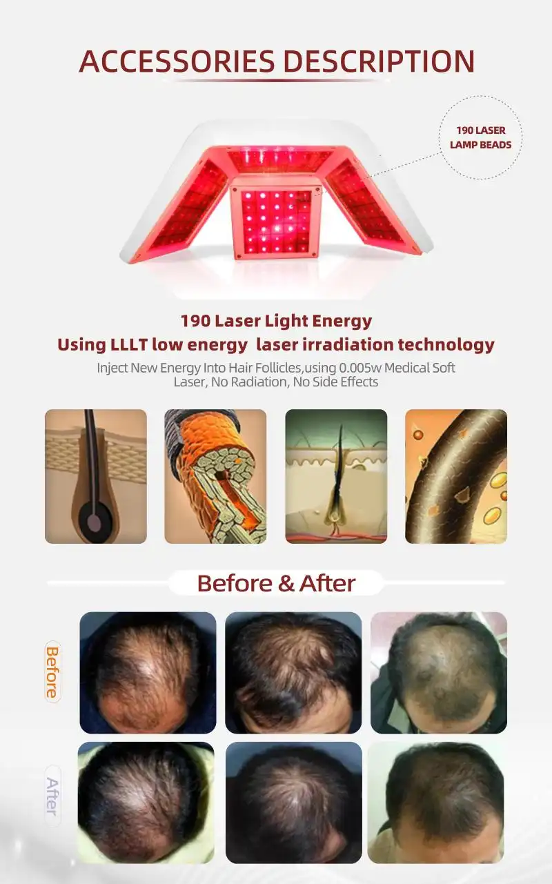 wholesale diode laser hair growth machine wholesale diode laser hair growth machine