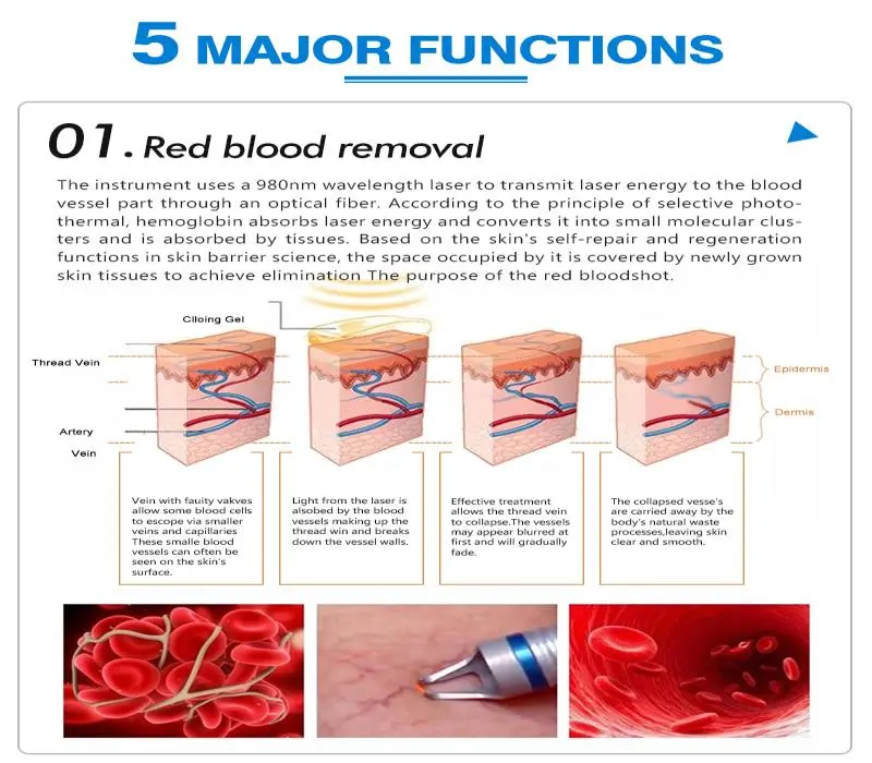 surgical liposuction machine for sale surgical liposuction machine for sale