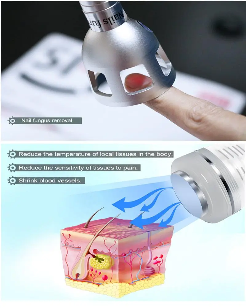 980 nm diode laser spider vein removal machine manufacturers 980 nm diode laser spider vein removal machine manufacturers