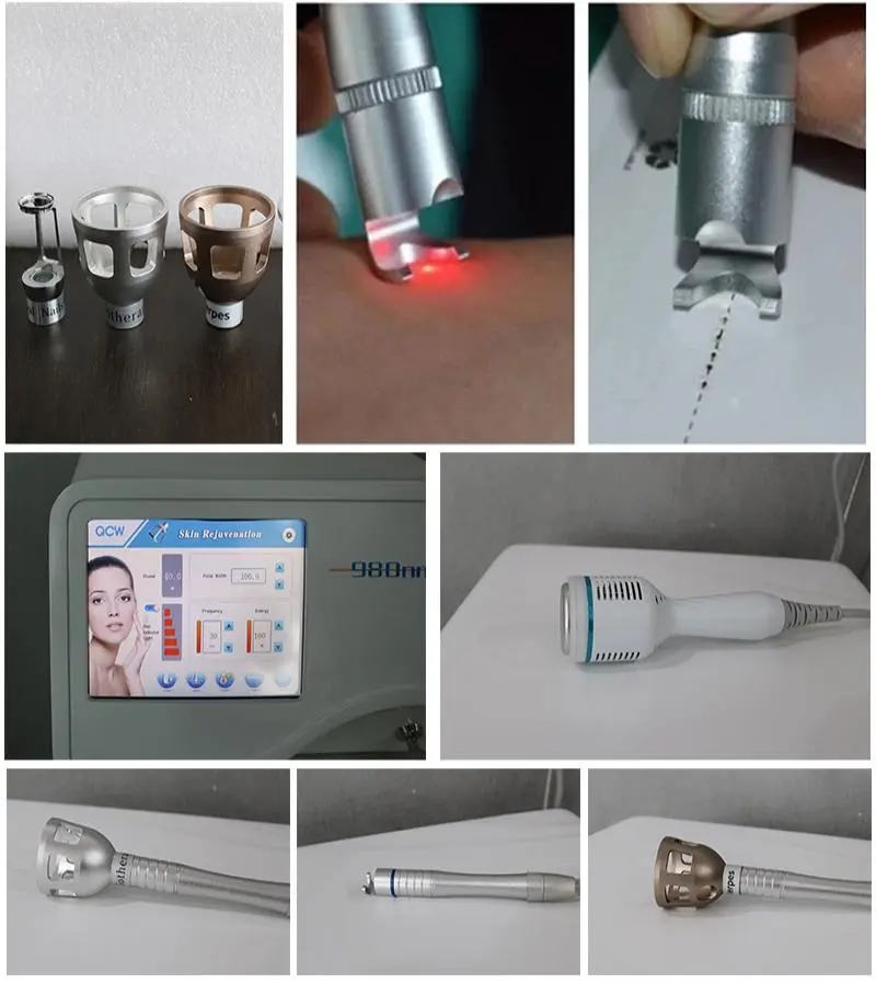 980nm diode laser spider vein removal machine 980nm diode laser spider vein removal machine