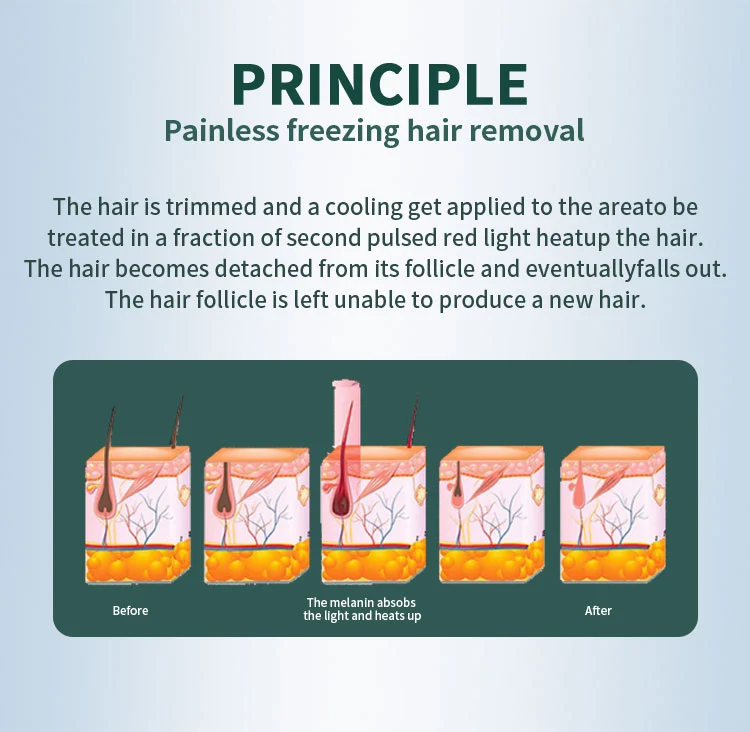 diode 808 laser hair removal machine made in China diode 808 laser hair removal machine made in China