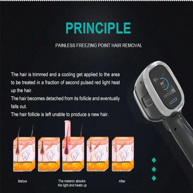wholesale medical laser hair removal machine wholesale medical laser hair removal machine