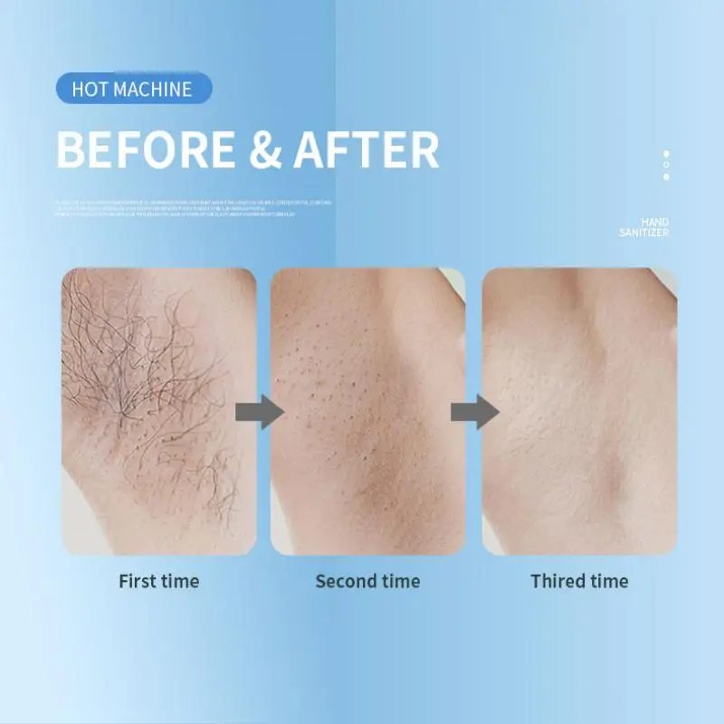 wholesale 808 nm laser hair removal wholesale 808 nm laser hair removal