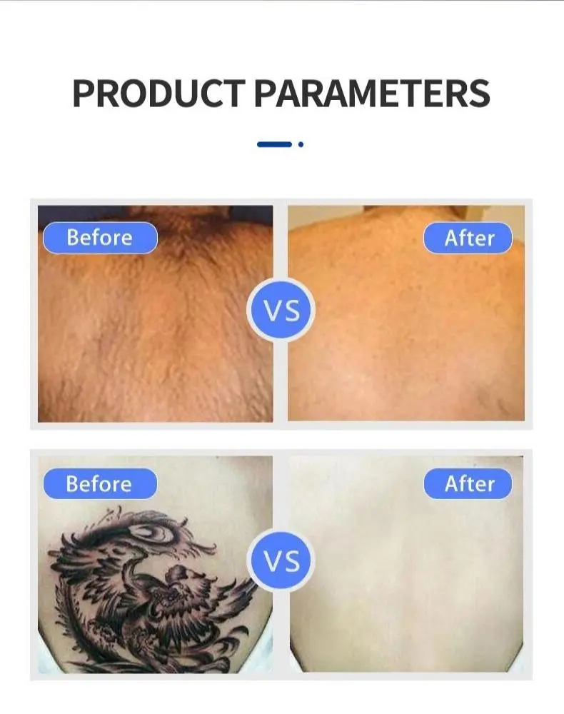 china skin air cooling machine factory china skin air cooling machine factory