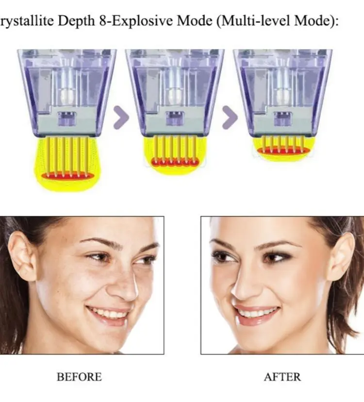 morpheus 8 rf microneedling machine made in China morpheus 8 rf microneedling machine made in China