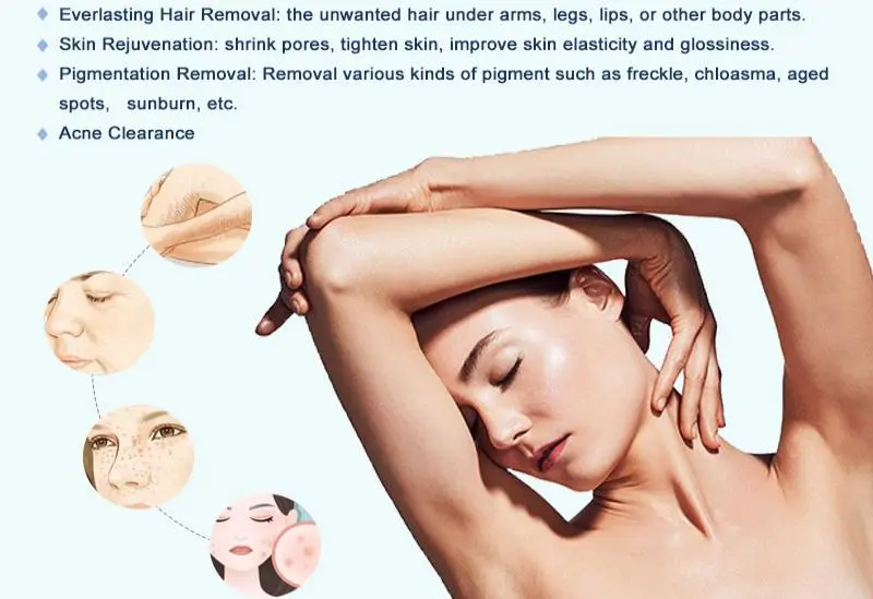 SHR hair removal machine made in China SHR hair removal machine made in China