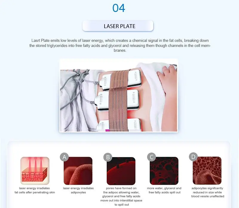 40k rf cavitation machine manufacturers 40k rf cavitation machine manufacturers