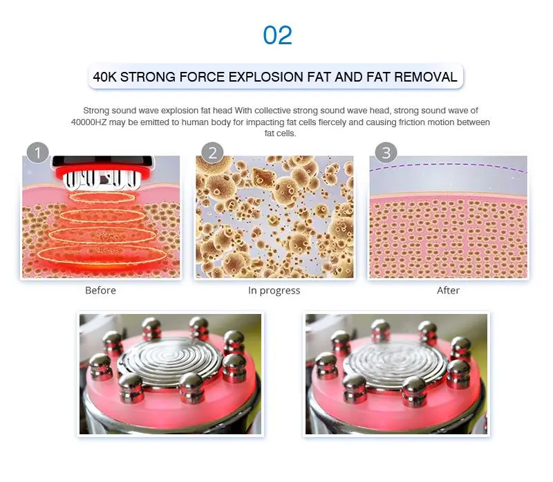 40k rf cavitation machine factory 40k rf cavitation machine factory