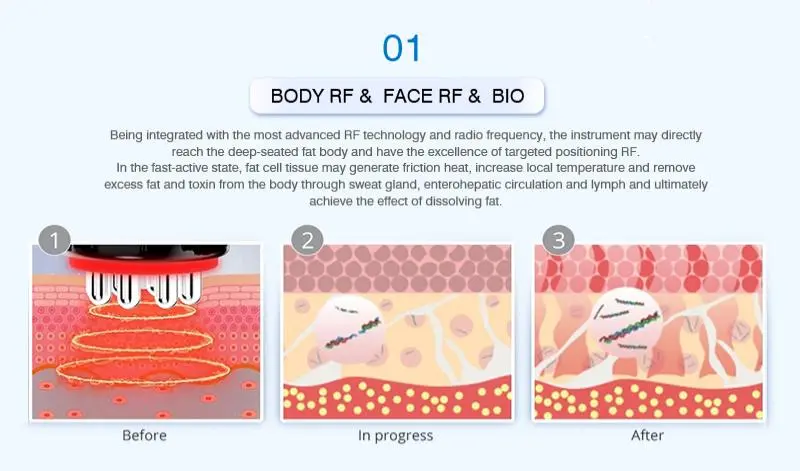 china 40k rf cavitation machine china 40k rf cavitation machine