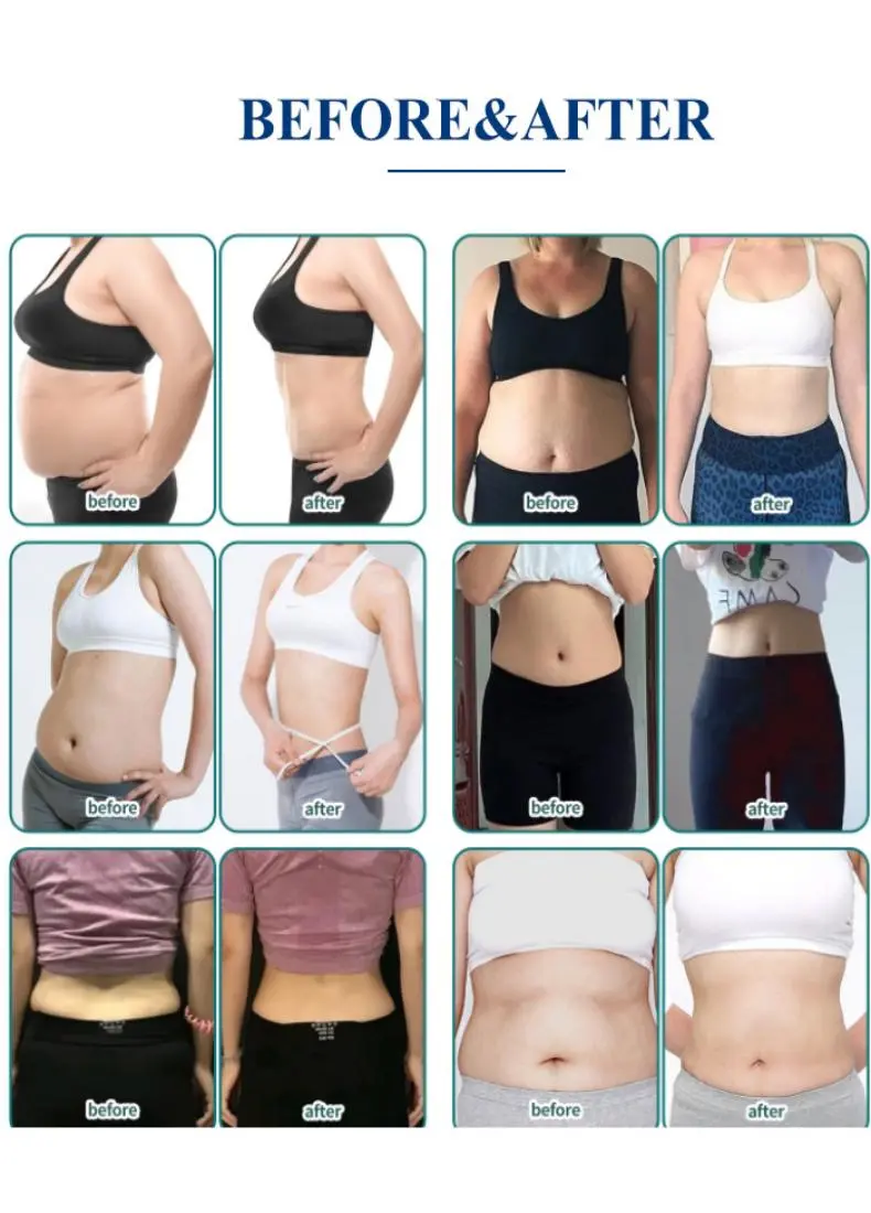 cryolipolysis slimming machine made in China cryolipolysis slimming machine made in China