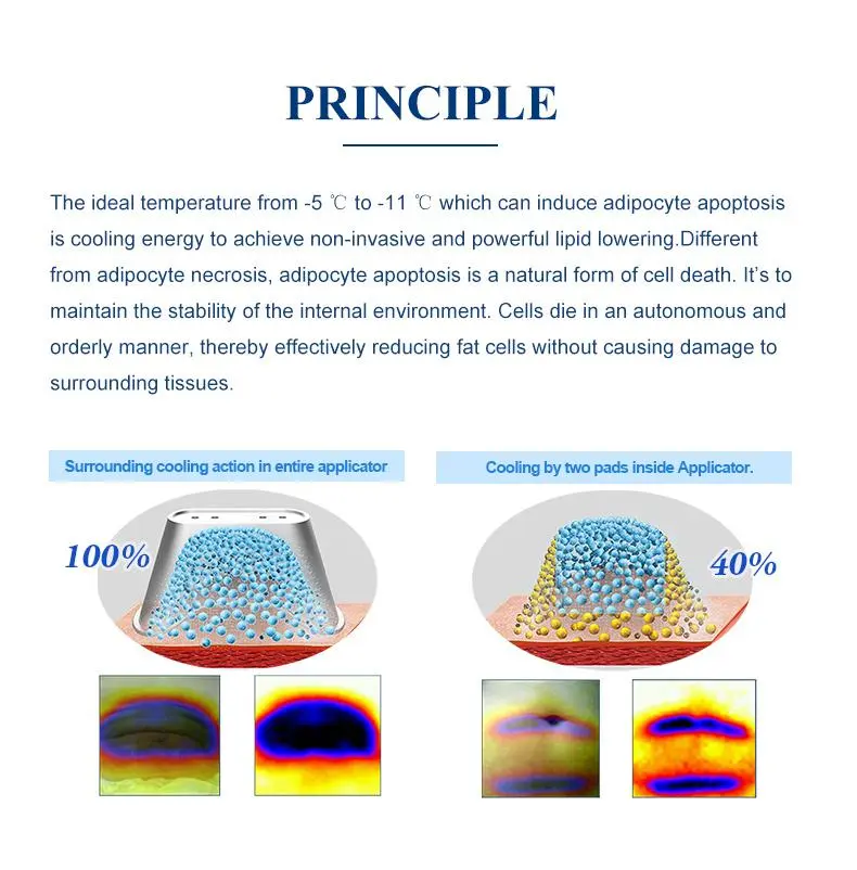 cryolipolysis slimming machine for sale cryolipolysis slimming machine for sale