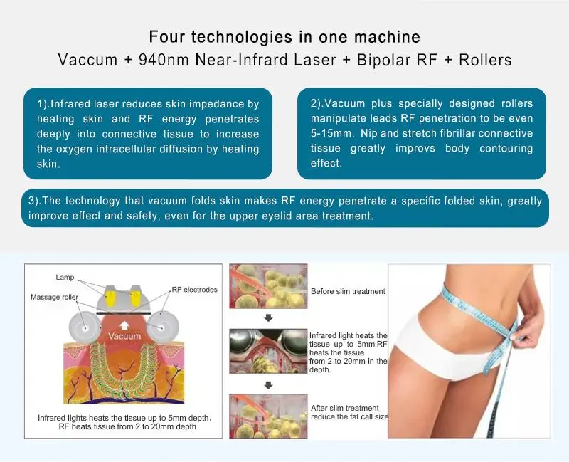 Velashape Slimming Machine for sale   Velashape Slimming Machine for sale