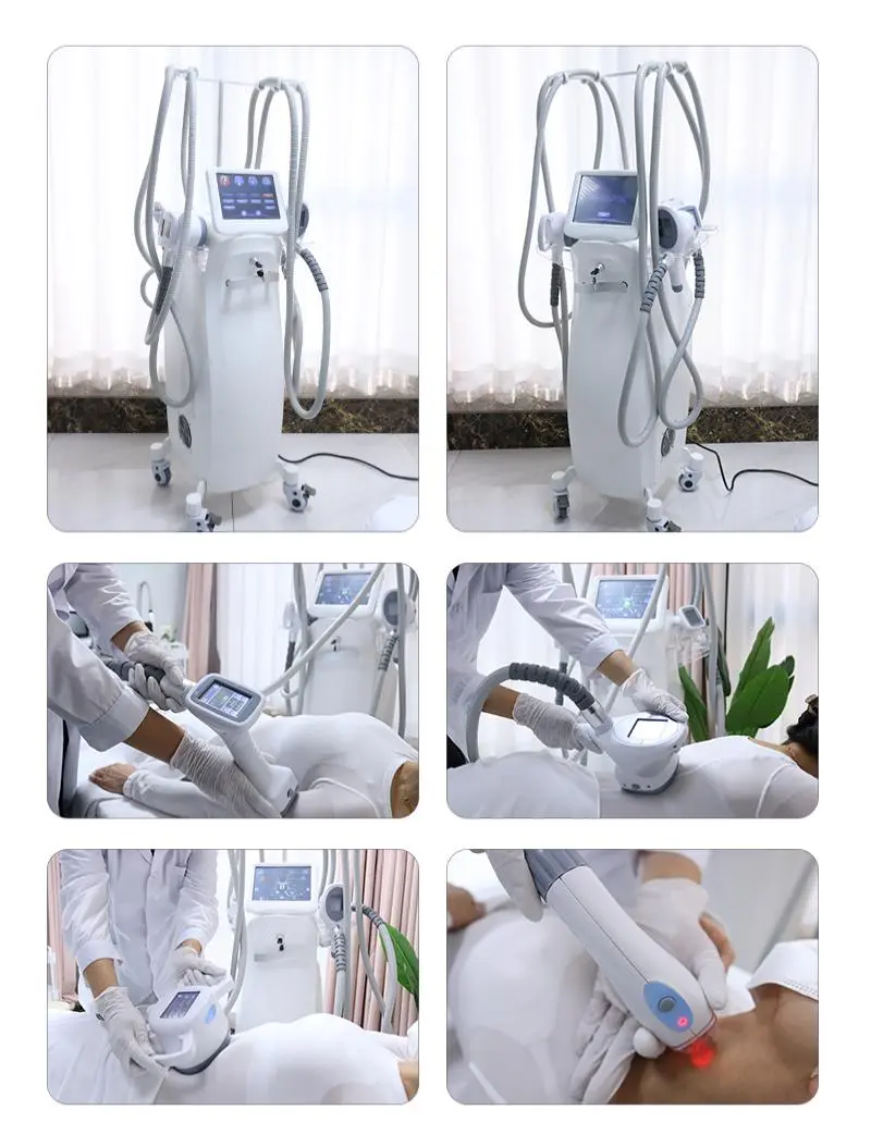 cellulite vacuum roller machine factory cellulite vacuum roller machine factory