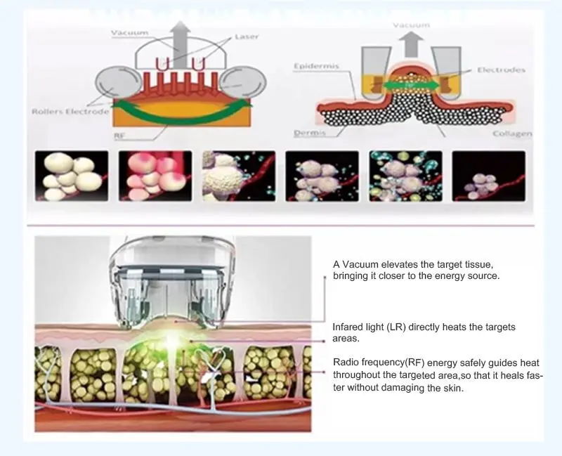 cellulite vacuum roller machine made in China cellulite vacuum roller machine made in China