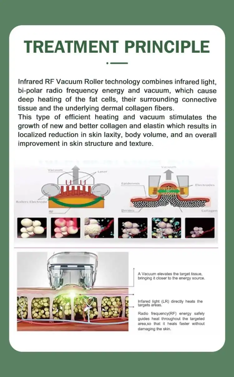 vacuum roller massage machine manufacturers vacuum roller massage machine manufacturers