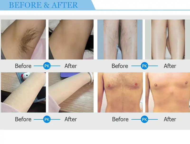 product-1-1 product-1-1