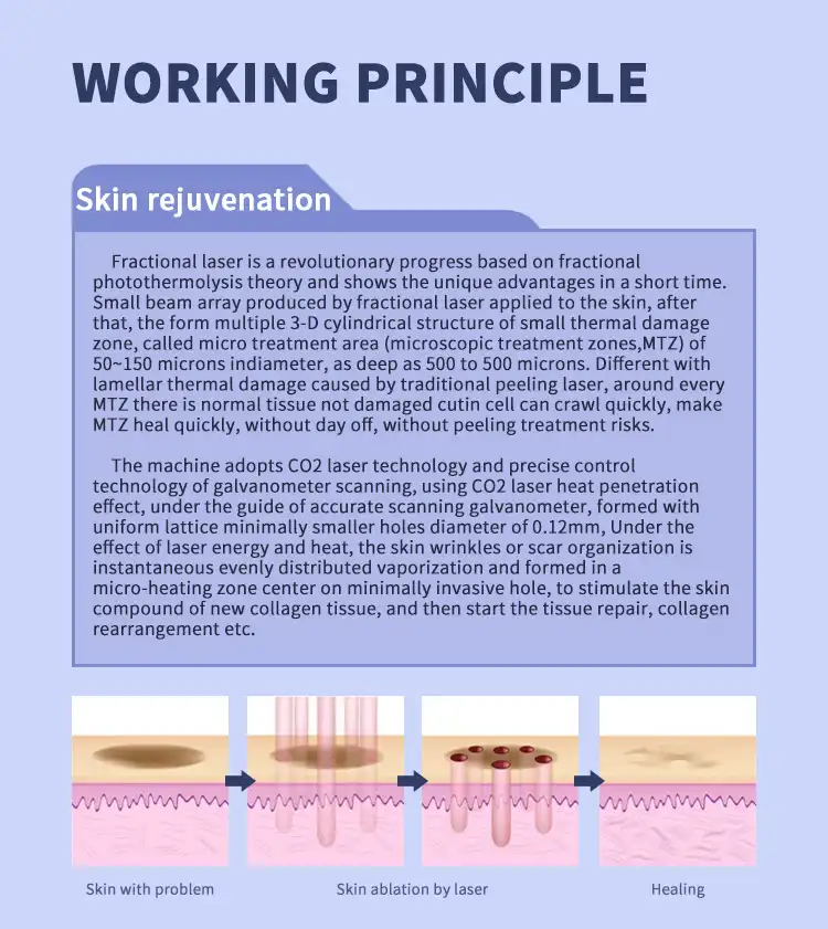 product-1-1 product-1-1