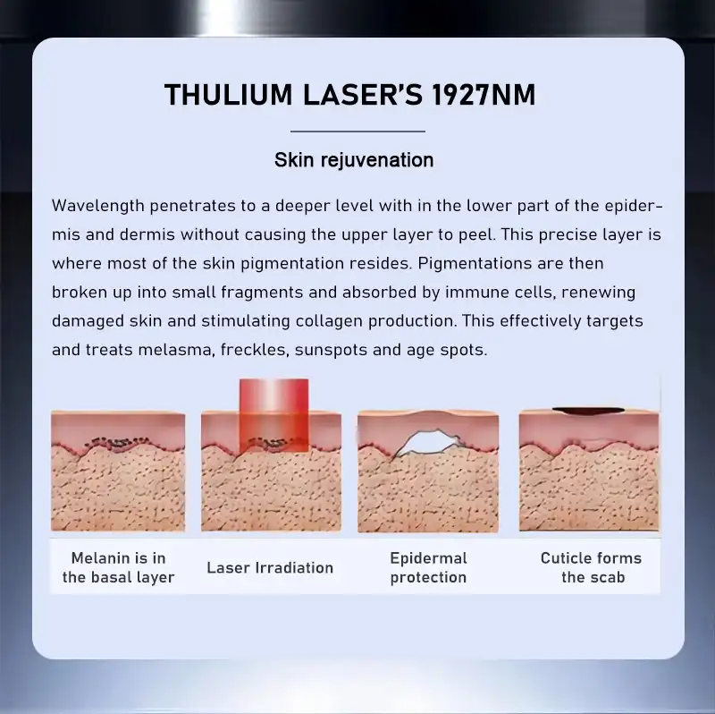 1927nm thulium laser machine 1927nm thulium laser machine