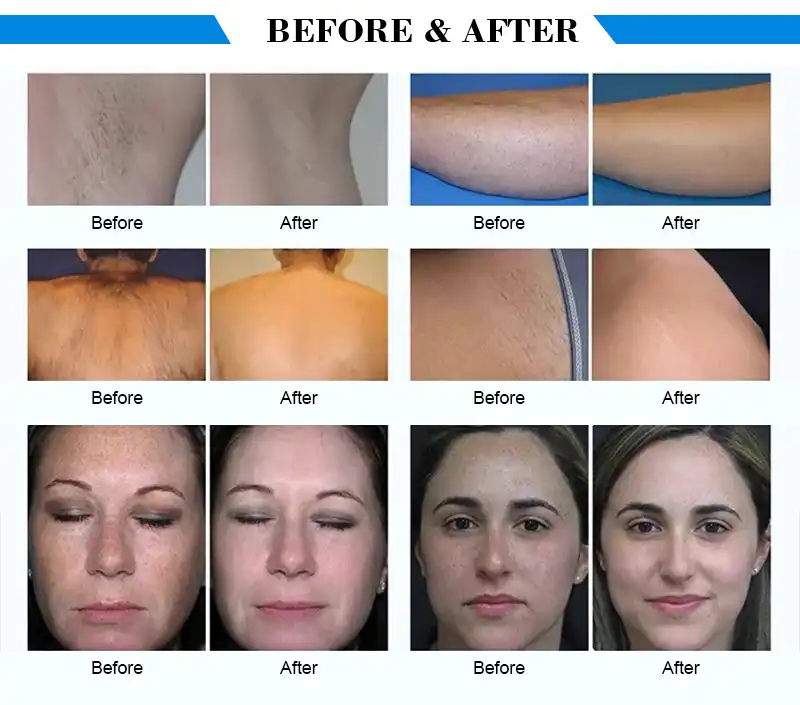 product-1-1 product-1-1