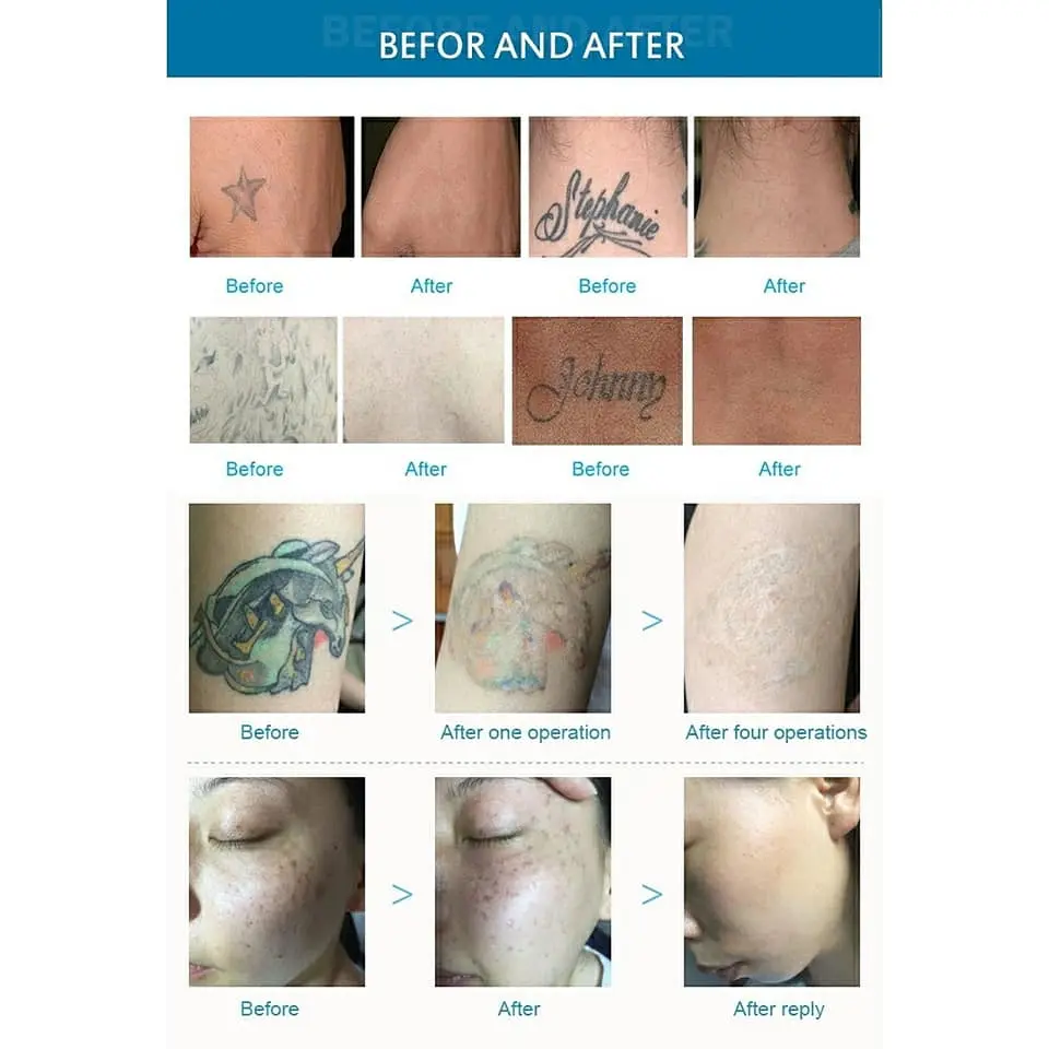 product-1-1 product-1-1