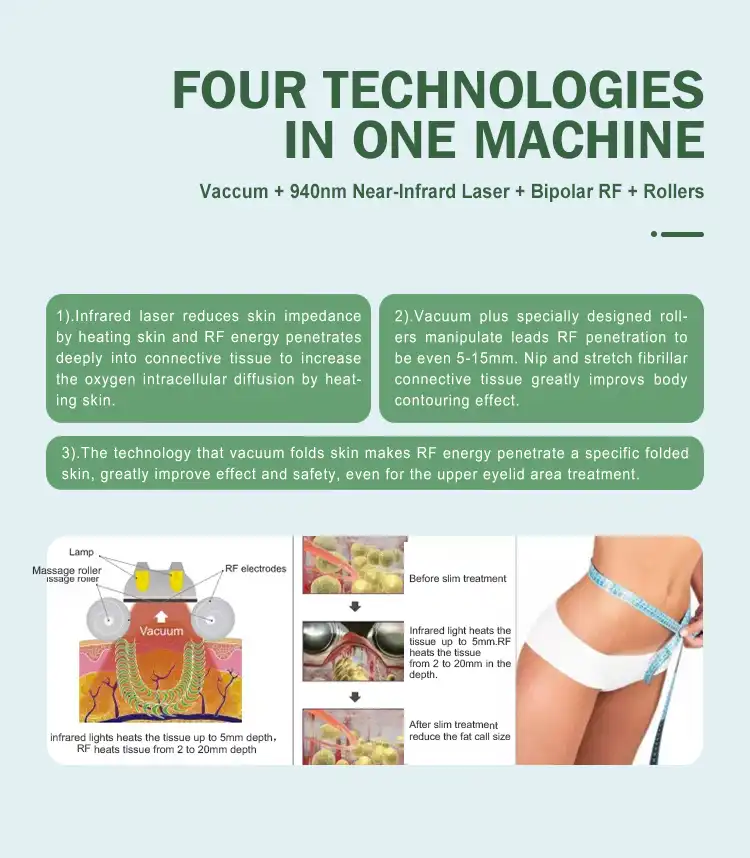 velashape body slimming machine velashape body slimming machine