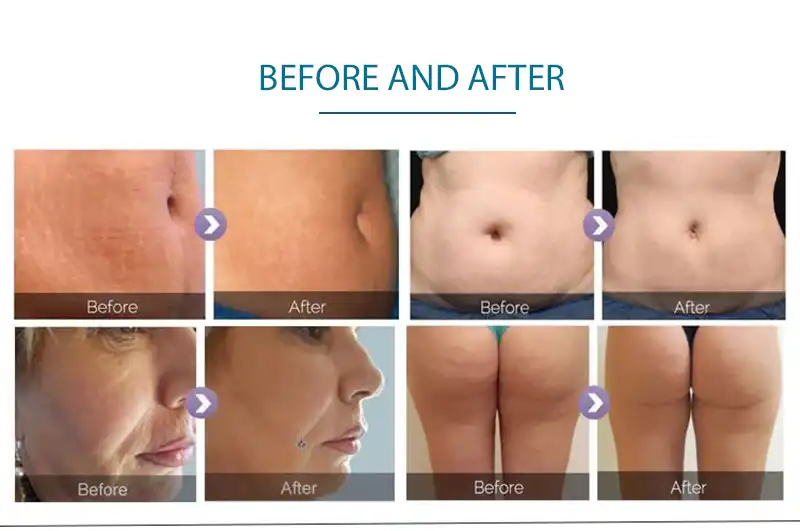 product-1-1 product-1-1