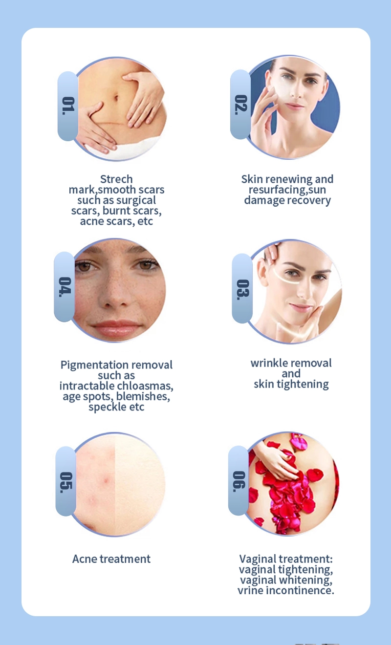 Portable CO2 fractional laser Portable CO2 fractional laser