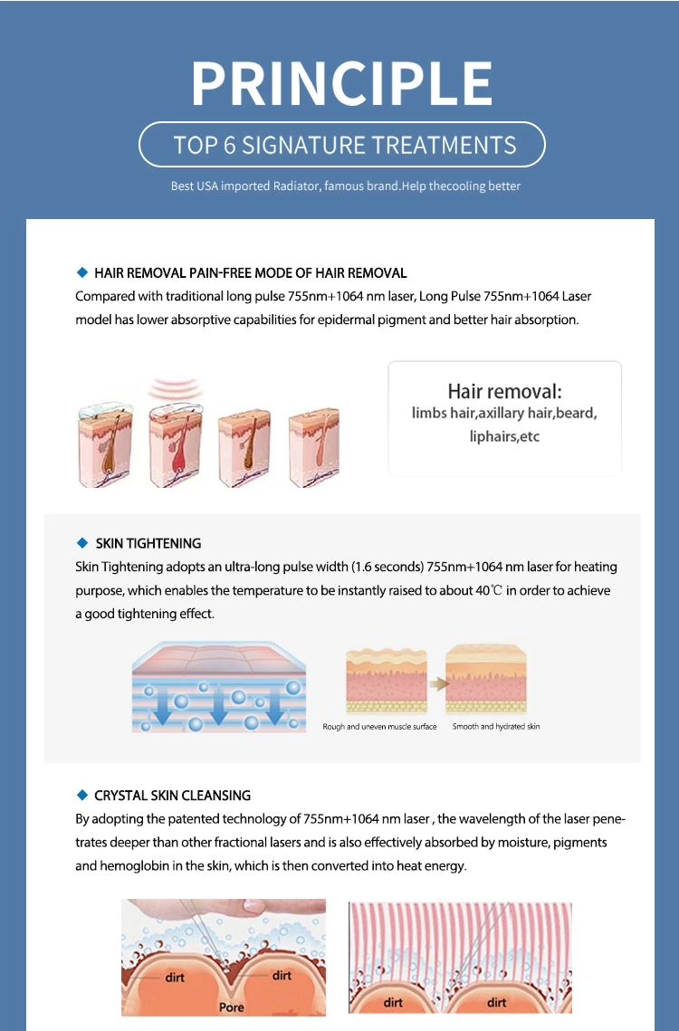 Long Pulse 1064 Laser Long Pulse 1064 Laser