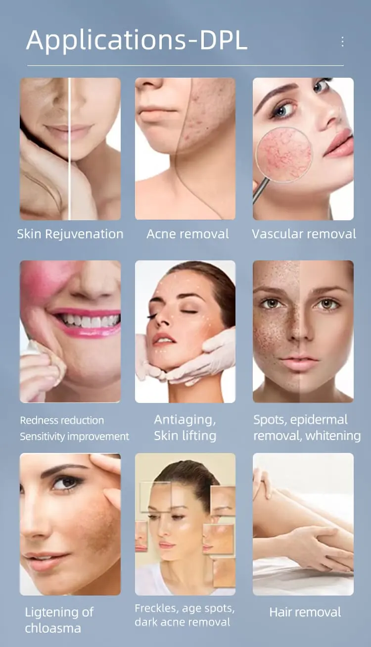 Portable DPL machine Portable DPL machine