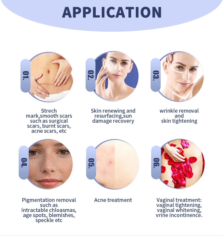 CO2 Fractional Laser2.0 CO2 Fractional Laser2.0