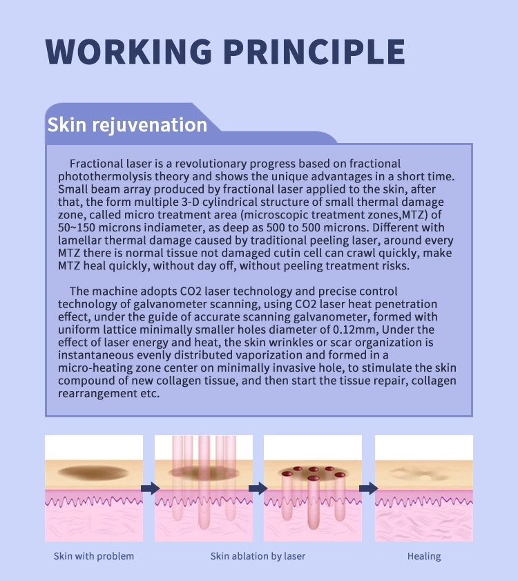 CO2 Fractional Laser2.0 CO2 Fractional Laser2.0