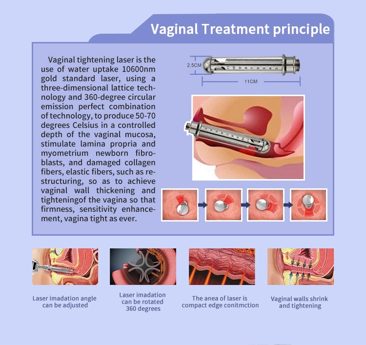 CO2 Fractional Laser2.0 CO2 Fractional Laser2.0