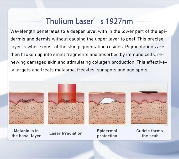 1927 nm thulium laser 1927 nm thulium laser