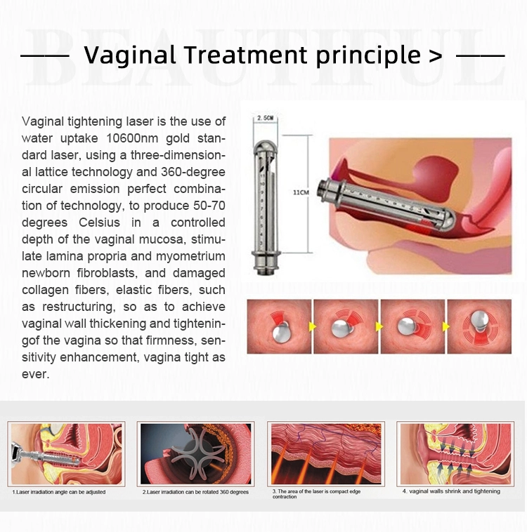 1927 nm thulium laser 1927 nm thulium laser