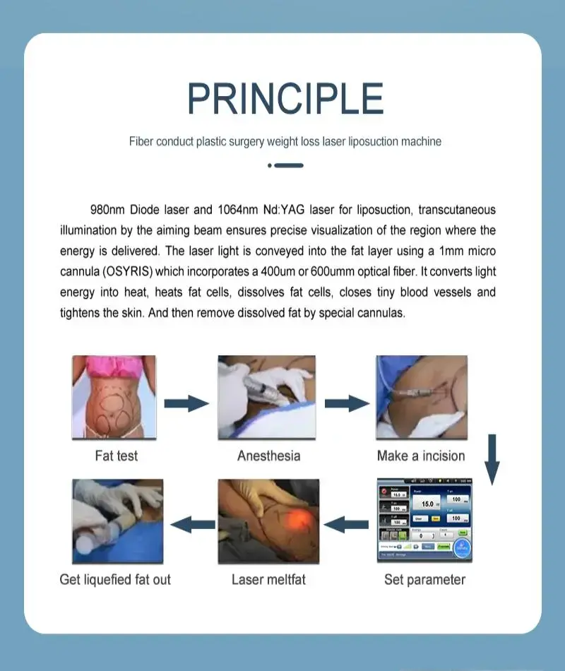 non invasive liposuction machine