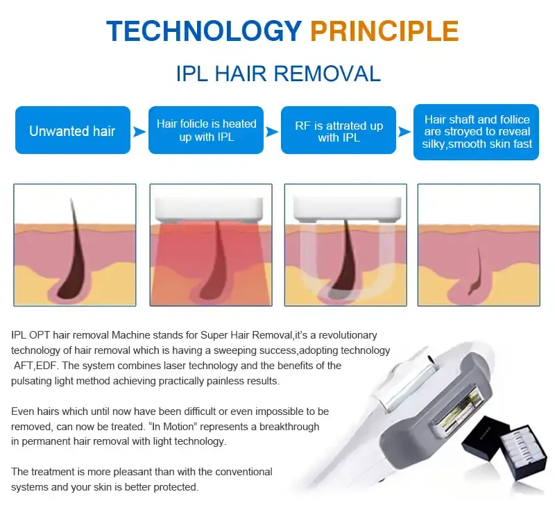 super hair removal machine