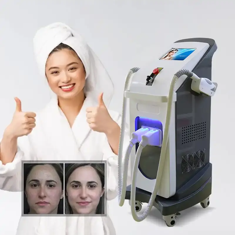 opt shr laser hair removal 
