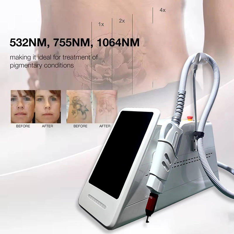 Tatto&Pigment Removal Laser