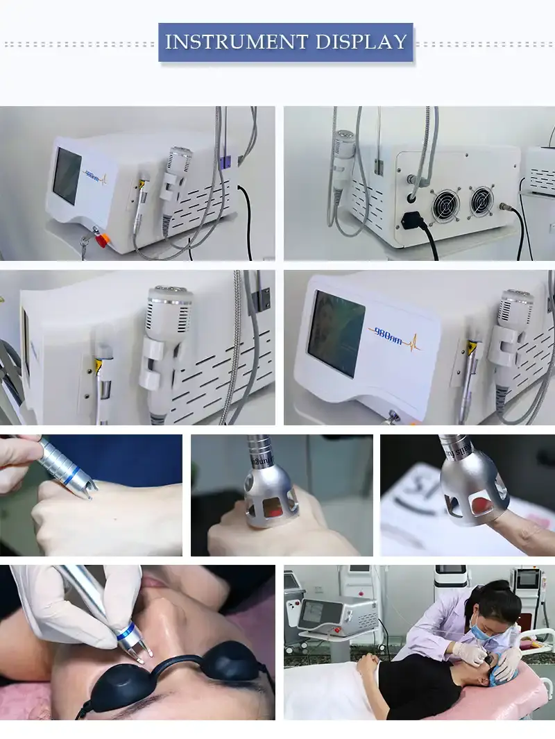 980 nm diode laser spider vein removal machine