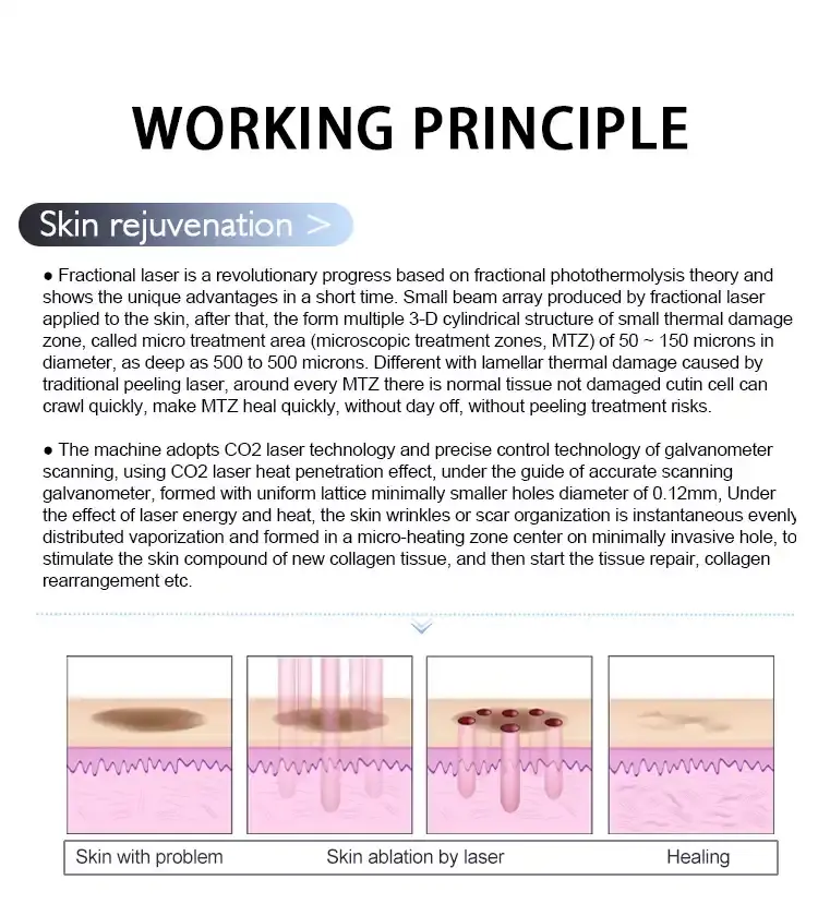 portable fractional co2 laser portable fractional co2 laser