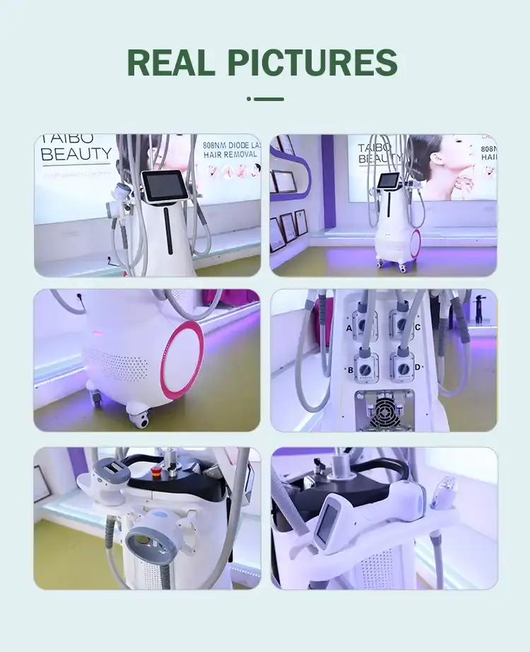 velashape body slimming machine