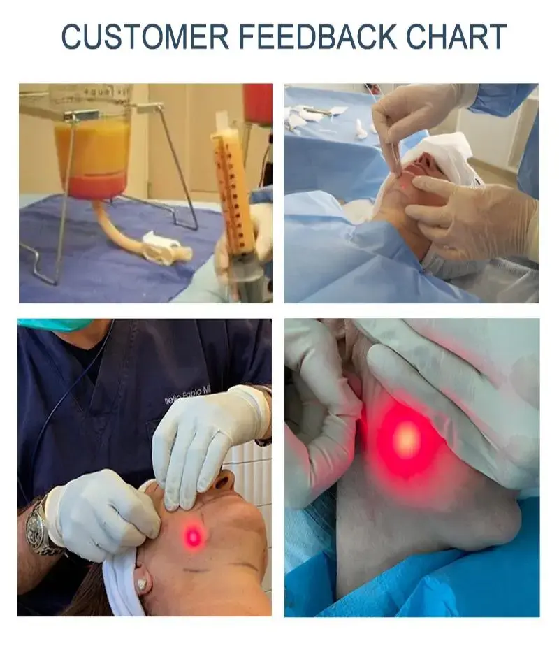 non invasive liposuction machine